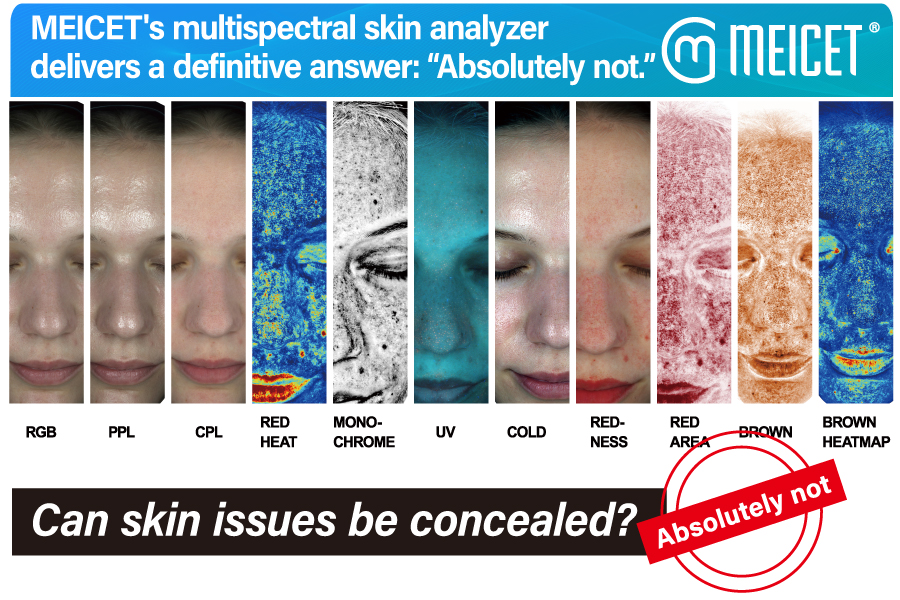 Can skin issues be concealed? MEICET’s multispectral skin analyzer delivers a definitive answer: “Absolutely not.”