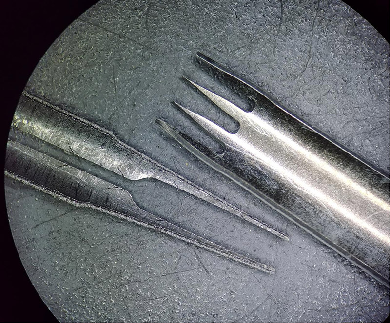 El láser de femtosegundo ayuda al rápido desarrollo de la fabricación de stents médicos de precisión