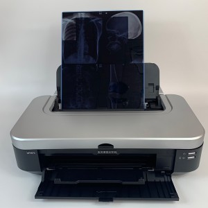 چاپگر فیلم پزشکی برای استفاده با دستگاه اشعه ایکس DR
