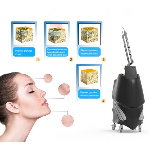 China Factory for China Hot Sale Pico Second Q Switched ND YAG Picosecond Laser Tattoo Removal Machine