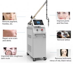 2021 Nuova macchina laser per la rimozione di tatuaggi e pigmentazione ND YAG