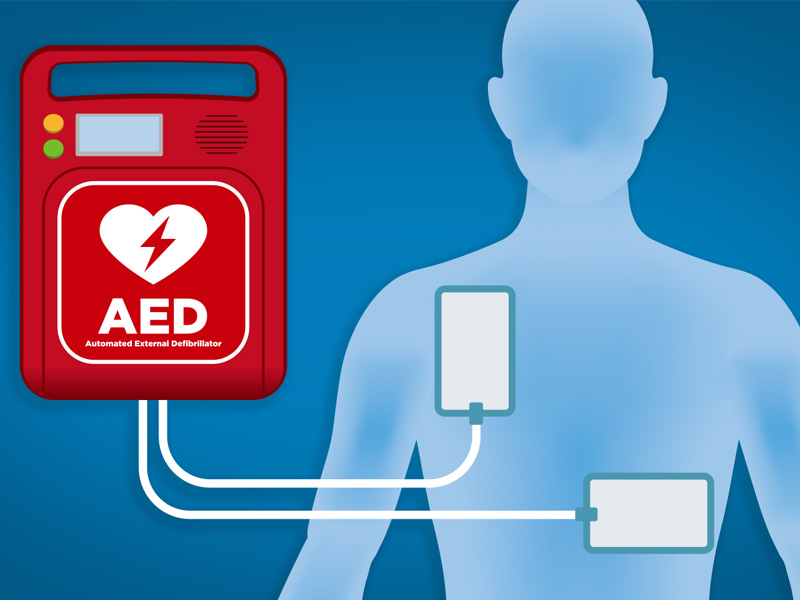 Разкриване на важната роля на високоволтовите резистори в AED