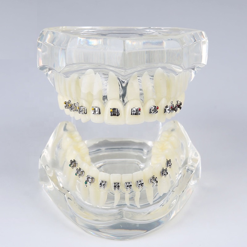 orthodontic dental M3001 metal bracket typodont adult teeth model demonstration practice wires education model