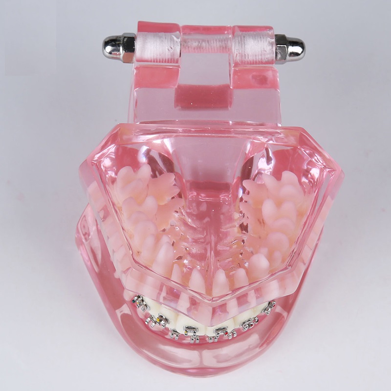 dental teeth study model M3001 dental orthodontics model with full metal brackets