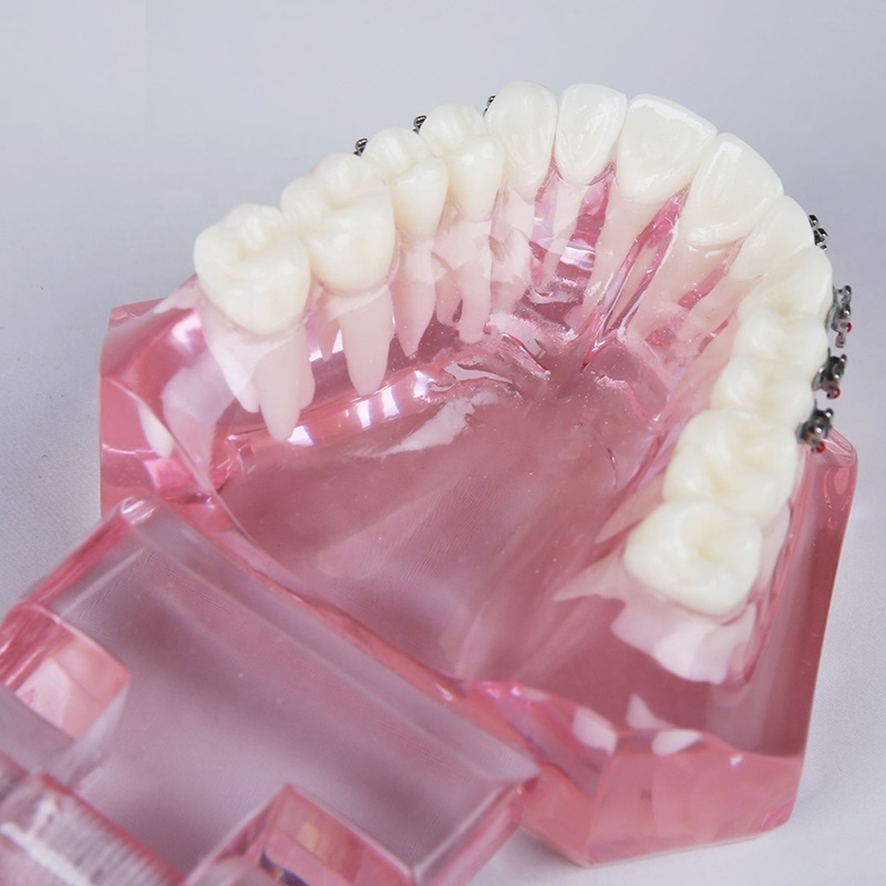 dental all metal brackets transparent orthodontic dental model for studying dental model practice wires and ligature ties