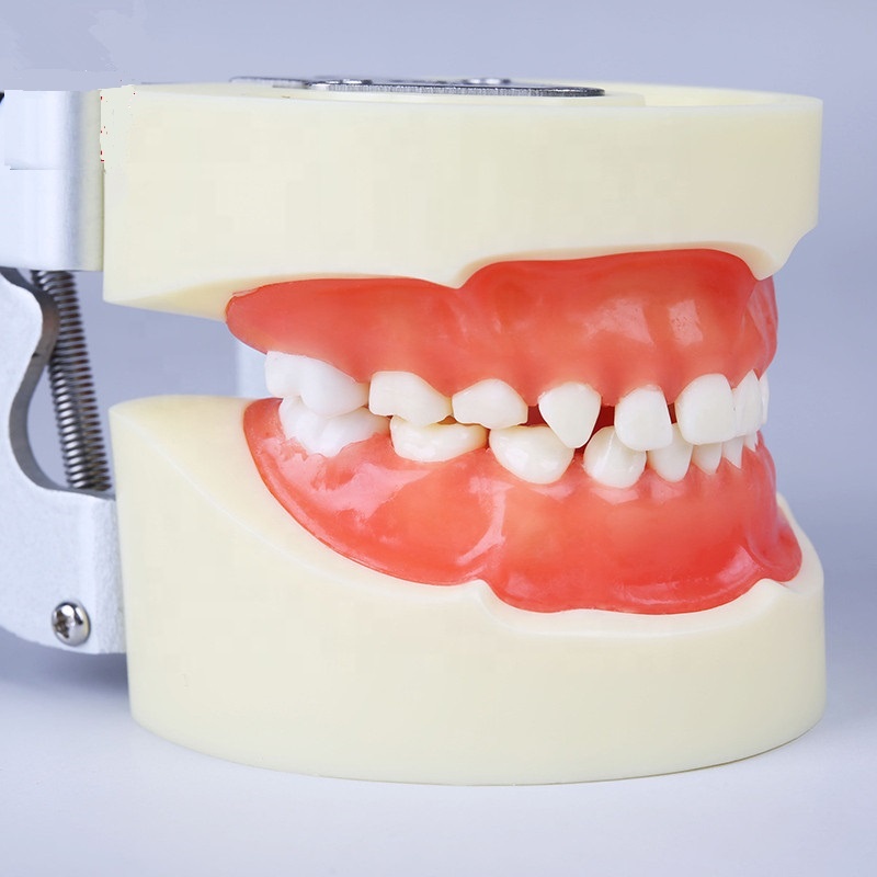 China Cheap price Portable Dental Hygiene Unit - Standard pediatric practice model dental baby teeth model advance PVC children tooth model installed into manikin – Onice