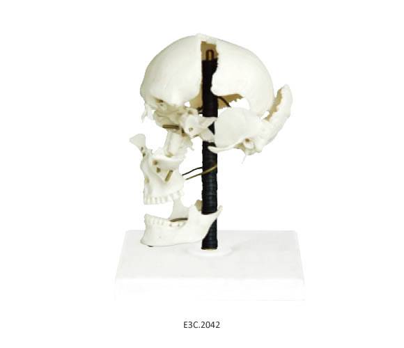 Model of Skull Bones