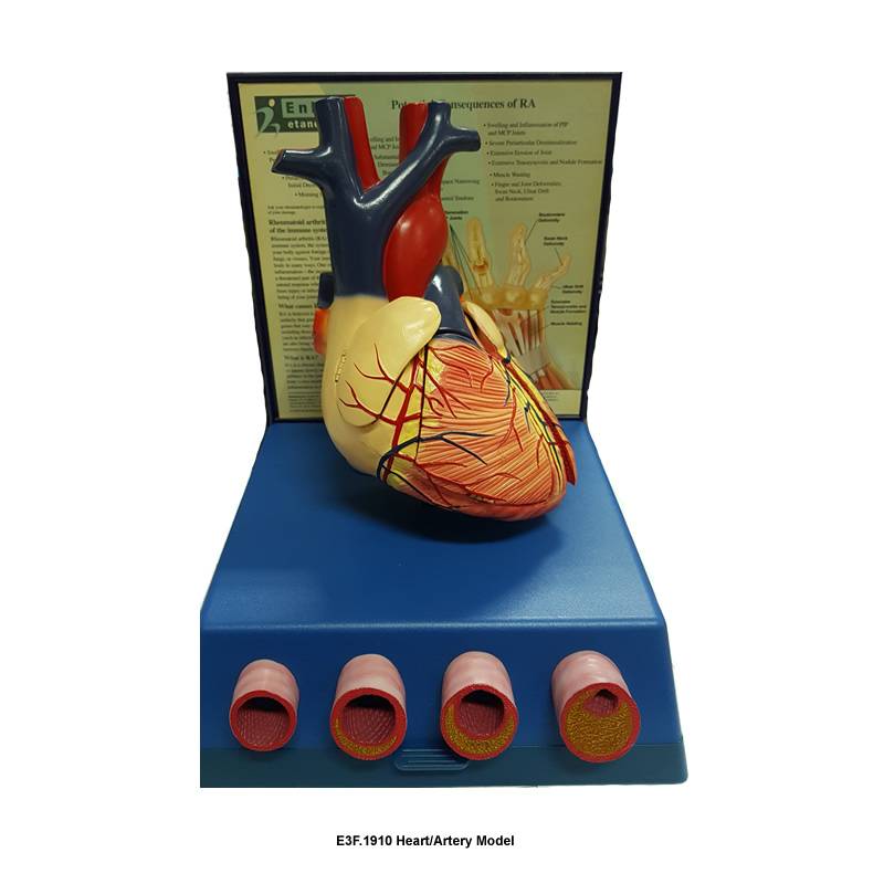 Heart/Artery Model