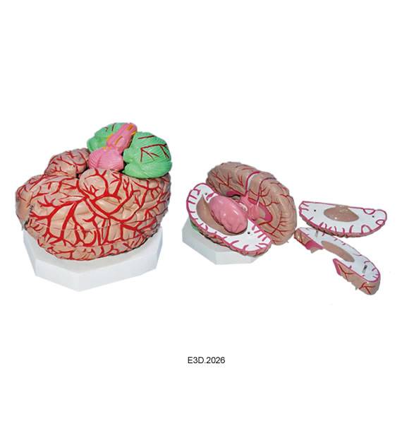 Enlarged Brain with Arteries Model