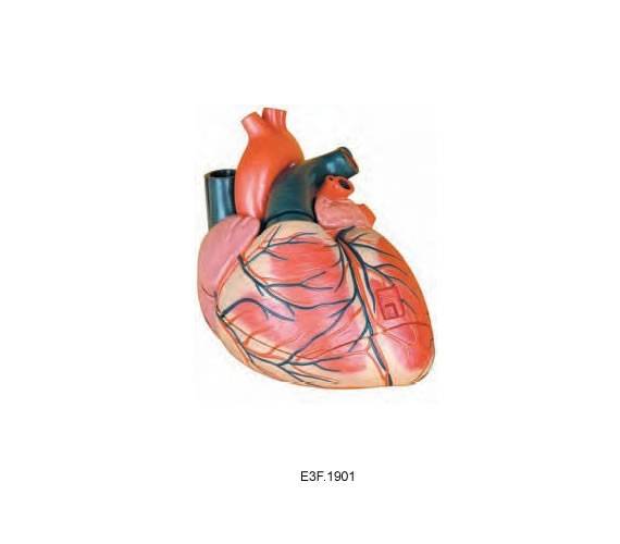 Enlarged Heart Model,3 parts