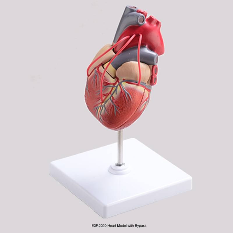 Heart Model with Bypass