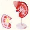 Kidney With Adrenal Gland ,2 parts