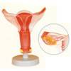 Internal Female Reproductive Organ