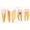 Incisor,Canine Tooth and Molar