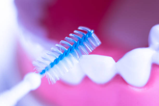 How to use an interdental brush?