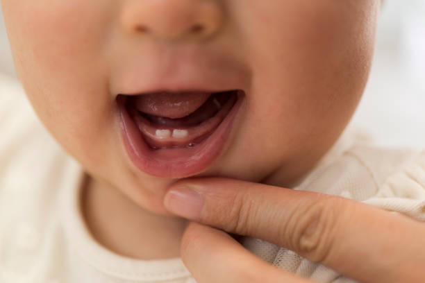 من المهم العناية بأسنان الأطفال