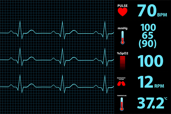 The Role Of Electrocardiogram Monitoring Electrode