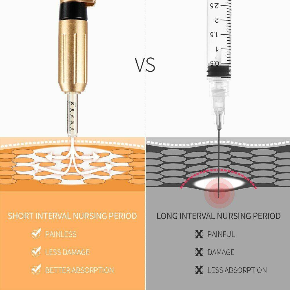 compare-with-injection