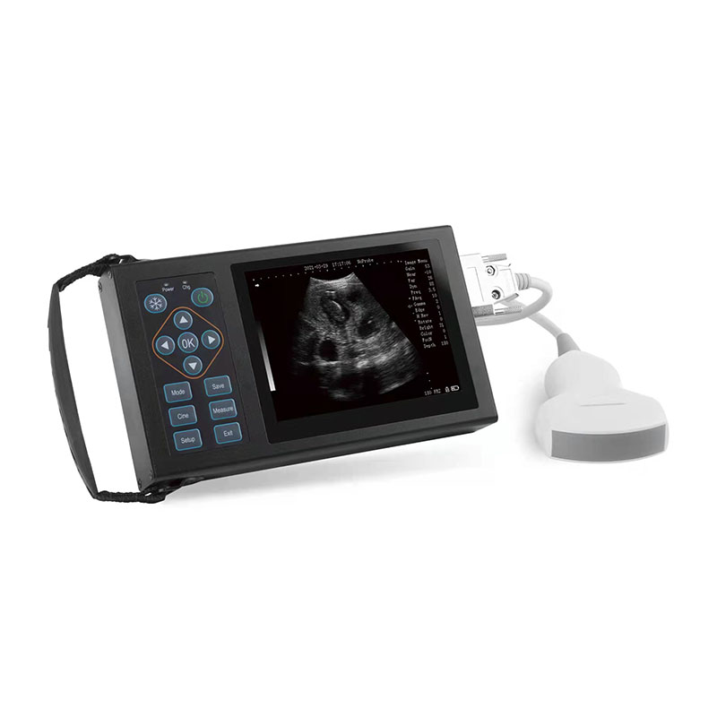 Imatge destacada de l'instrument de diagnòstic ultrasònic digital complet A10