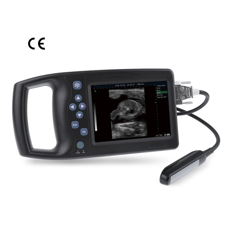 Imatge destacada de l'instrument de diagnòstic ultrasònic digital complet A8