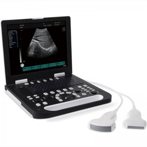 Kutengesa Kupisa RS-N50 ​​B/W Ultrasound Machine Mutengo