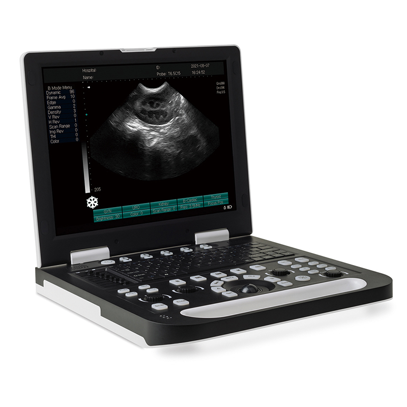 RS-N50(VET) Full Digital Laptop Ultrasound System
