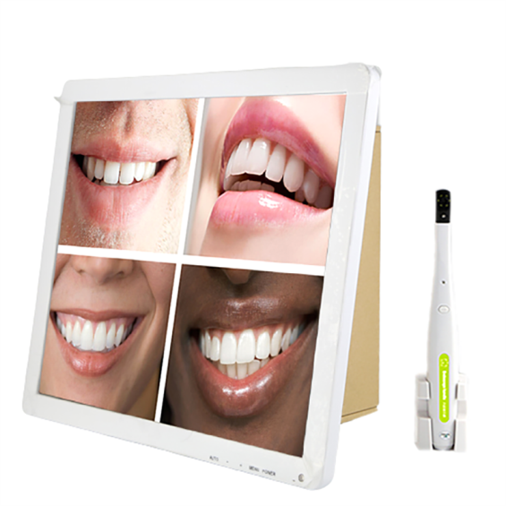 XC-26 Intra Oral Camera With 17 Inch Screen