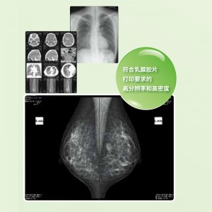Sackee Medical x-ray Film