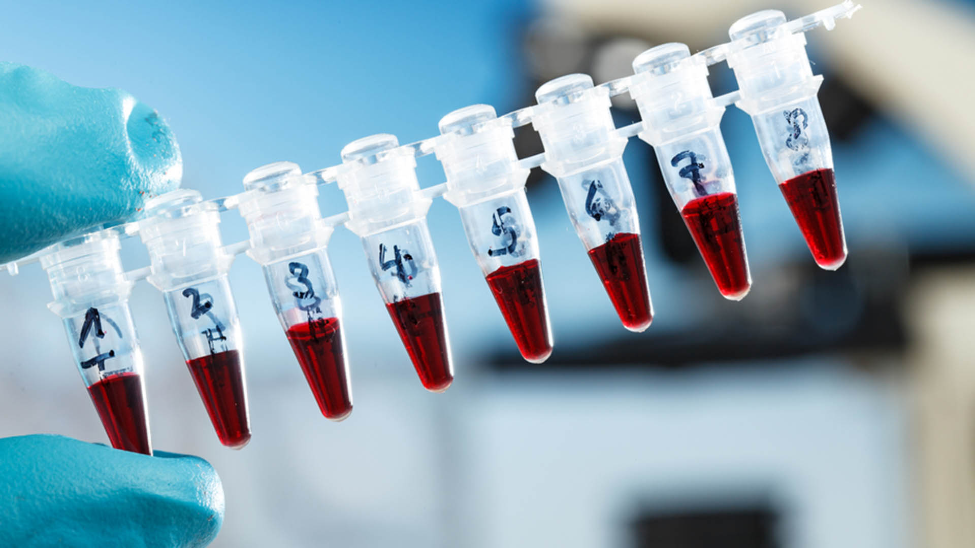 PCR tüpü ile santrifüj tüpü arasındaki fark nedir?
