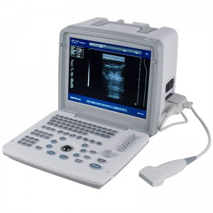 B/W Sistem Diagnostik Ultrasound Alat Perubatan Digital Penuh Ultrasonik