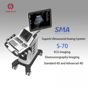 ဆေးရုံအတွက် Ultrasound စက် S70 တွန်းလှည်း 4D အရောင် doppler စကင်နာ ဆေးဘက်ဆိုင်ရာတူရိယာ USG