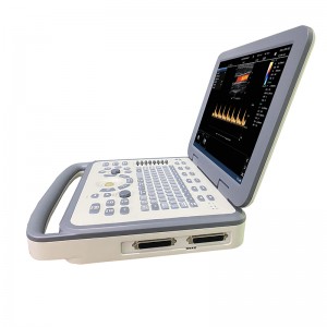 Makinë portative me ultratinguj M61 Sistemi i diagnostikimit me ngjyra doppler për skanerin e fletores me ultratinguj