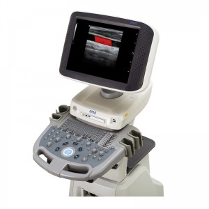 SM S60 Ултразвуков скенер 3D 4D цветна доплерова количка Сонографска диагностична система