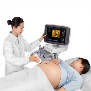 SM S60 Scanner à ultrasuoni 3D 4D trolley doppler di culore Sistema di diagnosi di sonografia