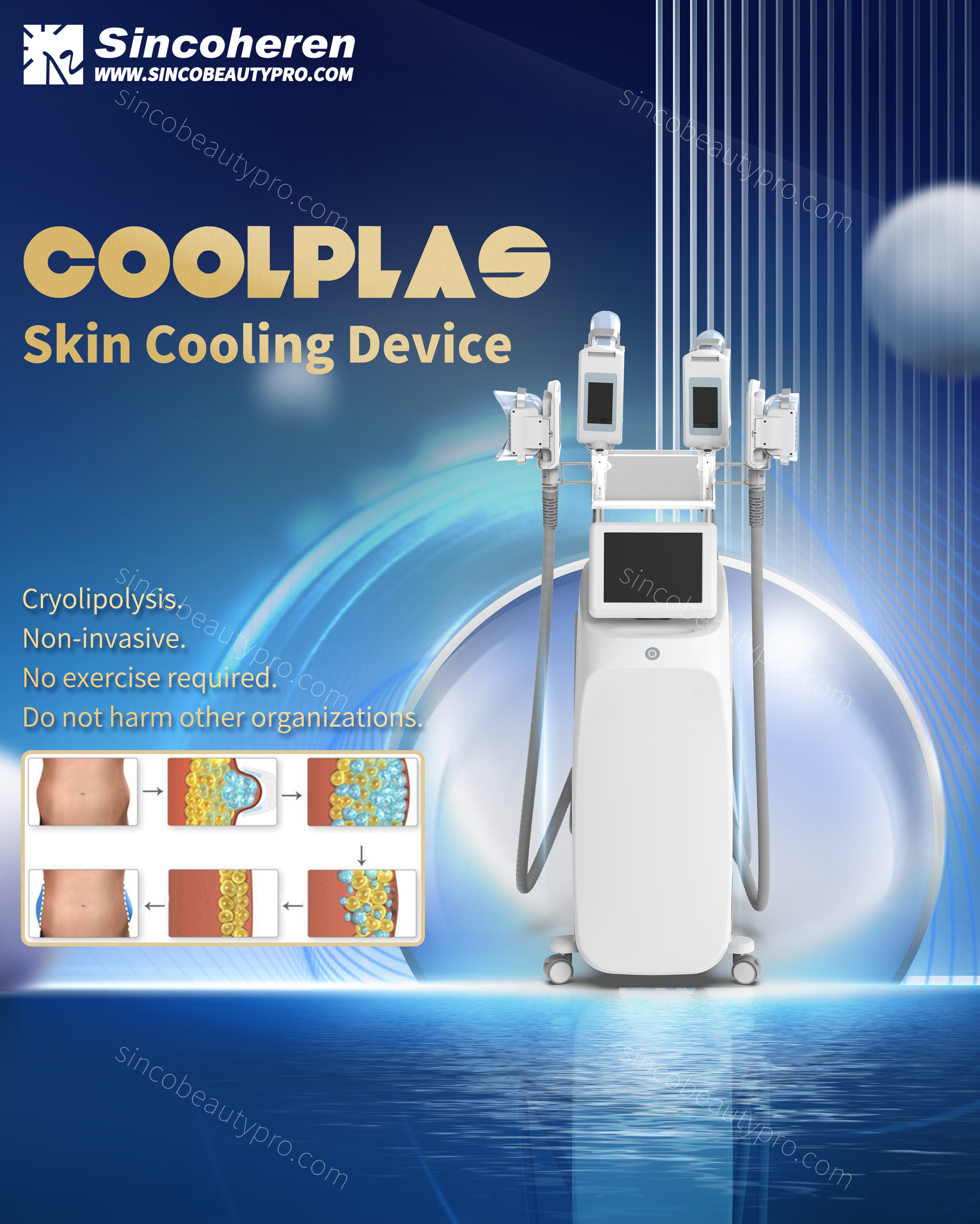 A Coolplas gép új modellje 4 fogantyúval, külön vezérléssel, nagyobb hatékonysággal