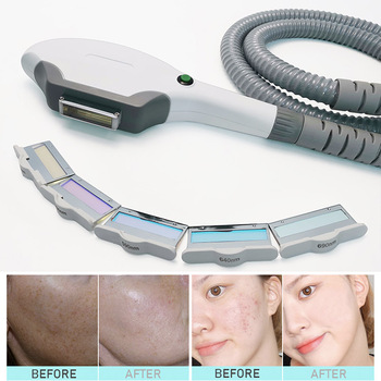 Najbardziej inteligentne urządzenie do usuwania włosów ipl urządzenie do odmładzania skóry urządzenie do usuwania włosów w klinice salonowej