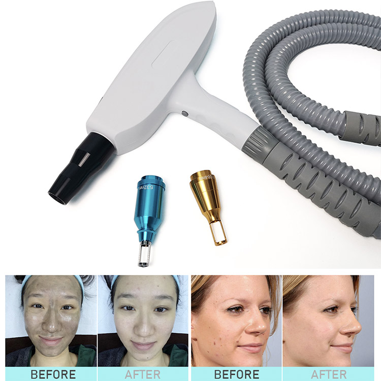 Newest popular Vascular Removal 980nm beauty cosmetics / IPL skin rejuvenation/Nd yag tattoo removal