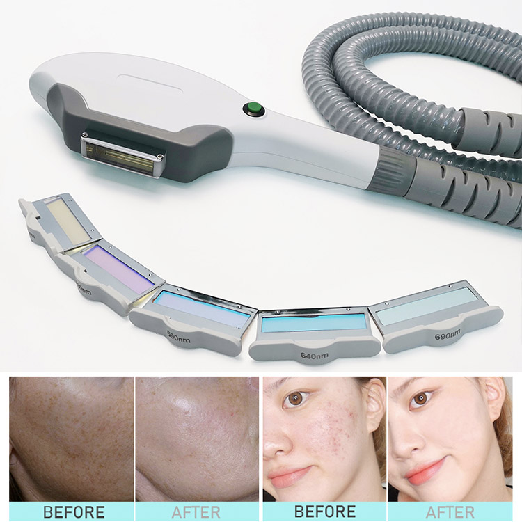 Dioda lasera senhaltigo Nd Yag Ipl Ipl Laser Maŝino Medicina Estetika Ekipaĵo Dioda Laser OPT/IPL Nd Yag Laser Maŝino