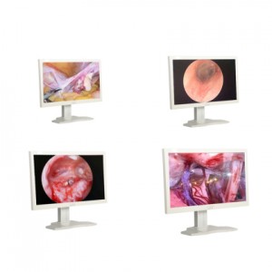 Medicinski endoskopski monitor