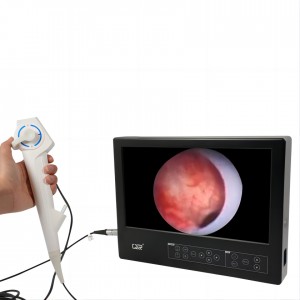All-in-one HD ureteroscope elektronika