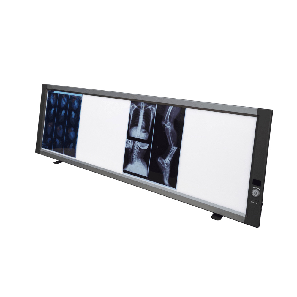 Bolnička četverostruka ploča Preglednik medicinskih filmova Digitalni zaslon dentalni negatoskop