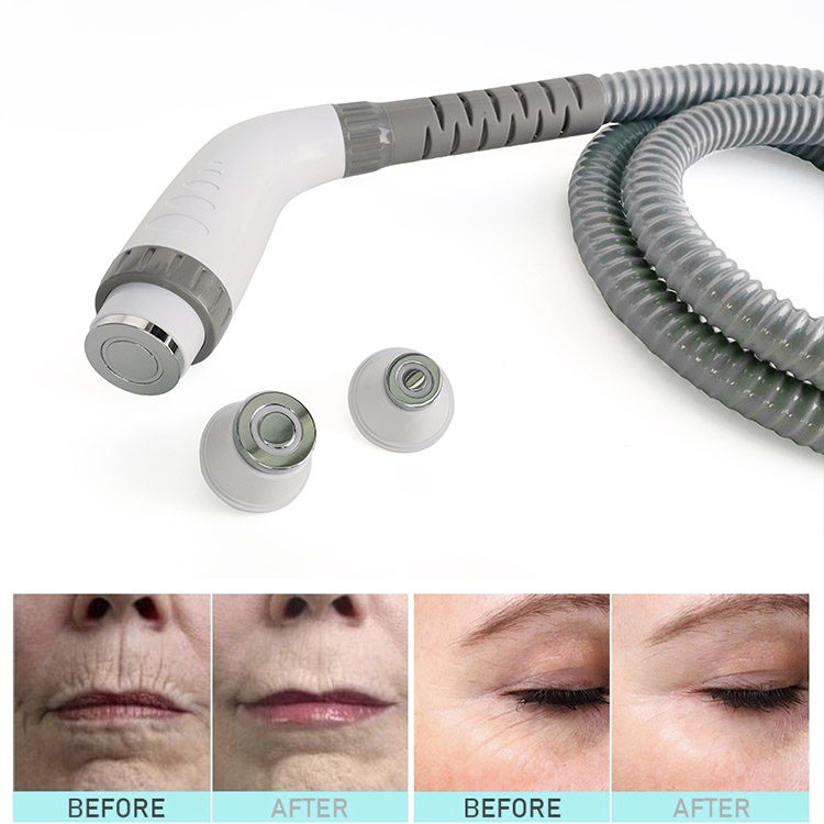 I-Multifunctional Laser opt shr ipl RF Laser Hair Removal Skin Treatment