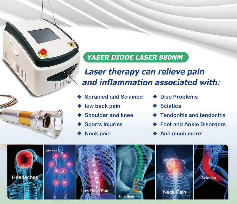 Laserová terapia