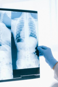 LQ HD meditsiiniline röntgentermofilm