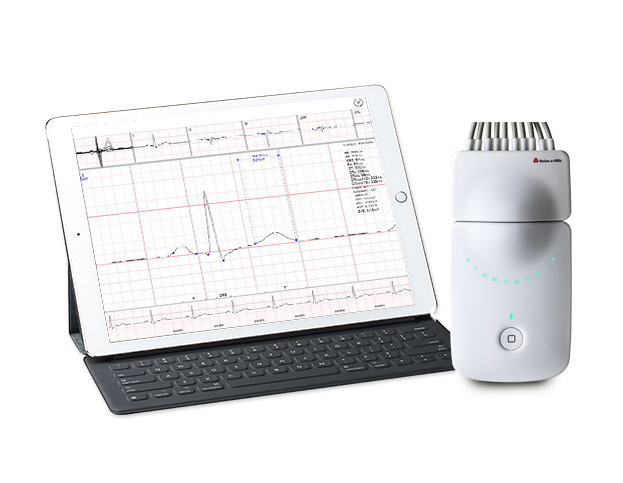 Cureus | 24-Hour Holter Monitoring for Identification of an Ideal Ventricular Rate for a Better Quality of Life in Atrial Fibrillation Patients