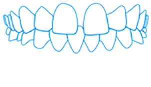 Show spaced teeth malocclusion