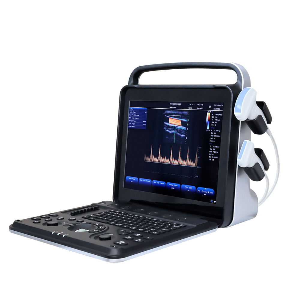 Magni tal-ultrasound Yonker Portable ġodda YK-UP8