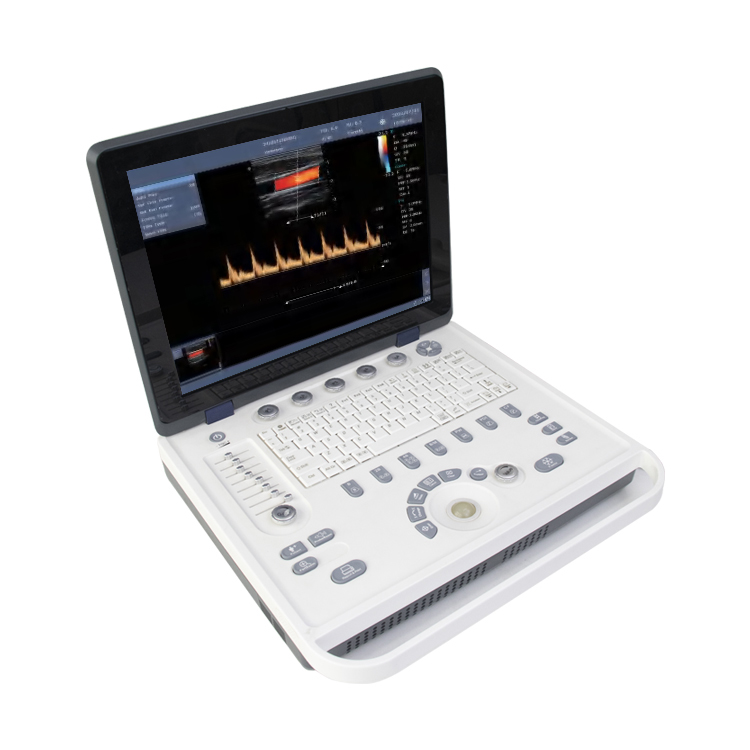 Inneal Ultrasound Doppler dath so-ghiùlain Yonker YK-UL8