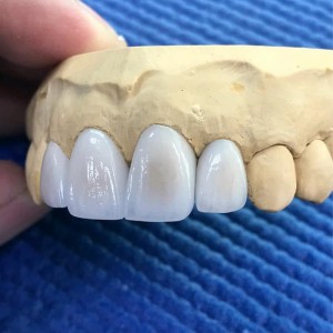 Dental Lithium Disilicate With High Translucent and Glass Ceramic Block for Dental Lithium Dislicate Blocks