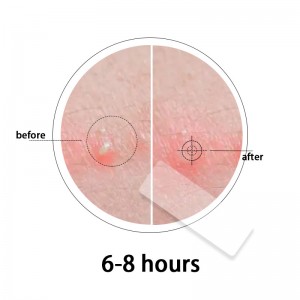 Plasture dreptunghiular mare transparent pentru acnee Plasture pentru acnee potrivit pentru toate tipurile de piele